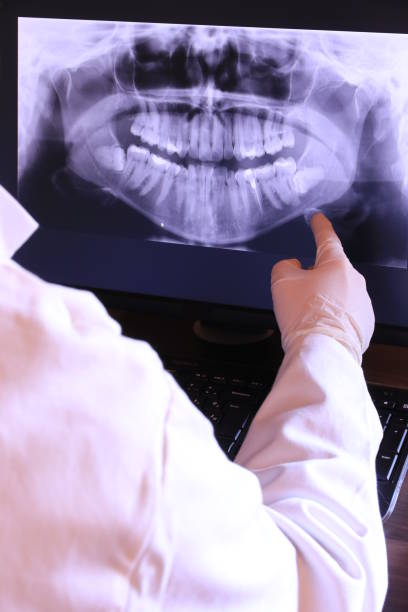 Best Emergency Root Canal Treatment in Blue Springs, MO