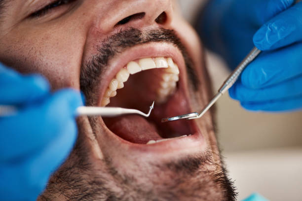 Best Emergency Treatment for Toothache in Blue Springs, MO