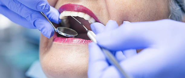 Best Walk-In Emergency Dentist in Blue Springs, MO
